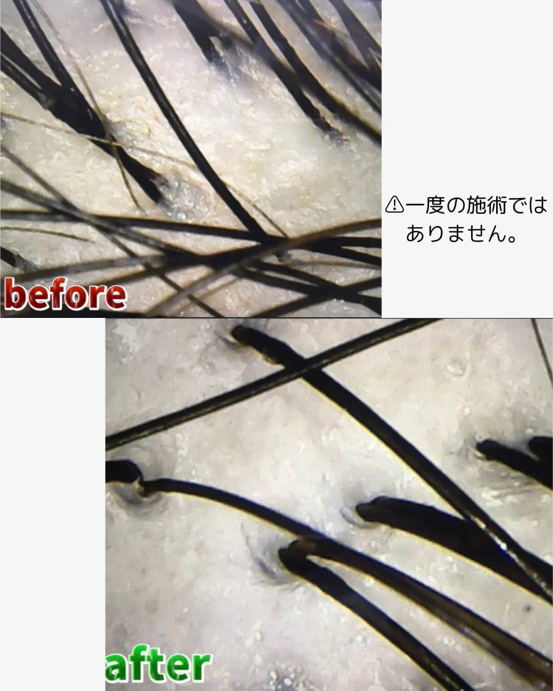 前橋市美容室　前橋市理容室　頭皮ケア