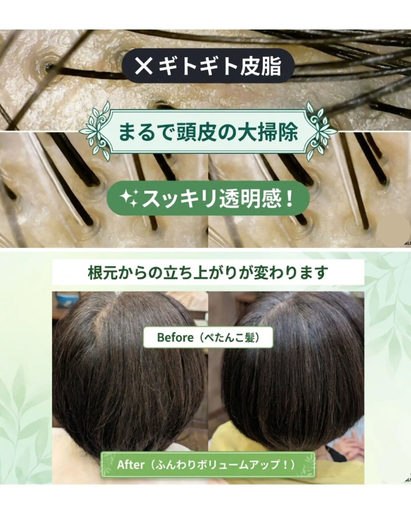 頭皮ケアするならANNEAU 前橋市美容室 前橋市理容室